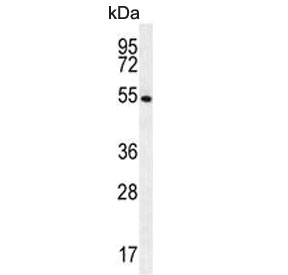 Western blot testing of human NCI-H460 cell lysate with GSR antibody. Predicted molecular weight ~56 kDa.