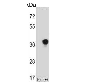 Western blot testing of 1) non-transfected and 2) transfected 293 cell lysate with MAP2K3 antibody.