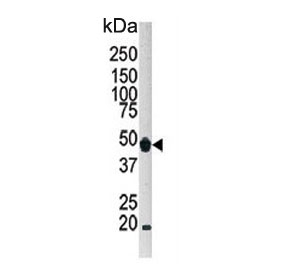 Western blot testing of human HeLa cell lysate with ATG4B antibody. Expected molecular weight: 37-52 kDa (multiple isoforms).