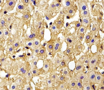 IHC testing of FFPE human liver tissue with Hemoglobin subunit gamma-2 antibody. HIER: steam section in pH6 citrate buffer for 20 min and allow to cool prior to staining.