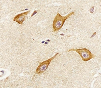 IHC testing of FFPE human brain tissue with PIP4K2 alpha antibody. HIER: steam section in pH6 citrate buffer for 20 min and allow to cool prior to staining.