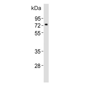 Western blot testing of mouse pancreas tissue lysate with Nr4a2 antibody. Predicted molecular weight ~67 kDa.