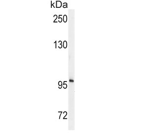 Western blot testing of mouse cerebellum tissue lysate with ENPP2 antibody. Expected molecular weight: 99-125 kDa depending on glycosylation level.
