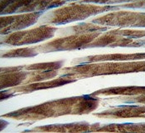 IHC testing of FFPE human skeletal muscle tissue with ILKAP antibody. HIER: steam section in pH6 citrate buffer for 20 min and allow to cool prior to staining.