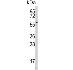 Western blot testing of human NCI-H460 cell lysate with Beta-secretase 1 antibody. Predicted molecular weight ~56 kDa.