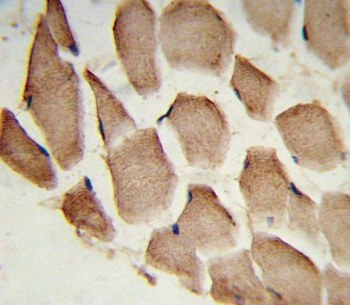 IHC testing of FFPE human skeletal muscle tissue with ARPC1A antibody. HIER: steam section in pH6 citrate buffer for 20 min and allow to cool prior to staining.