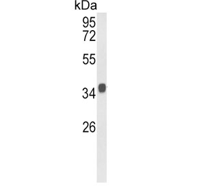 Western blot testing of mouse stomach lysate with KLF6 antibody. Expected molecular weight: 32-40 kDa.