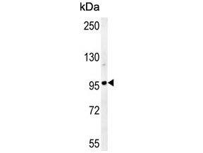 Western blot testing of human HeLa cell lysate with GIT1 antibody. Expected molecular weight: 84-95 kDa.