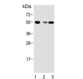 Western blot testing of 1) human brain, 2) mouse brain and 3) rat brain tissue lysate with Activin receptor type-1B antibody. Predicted molecular weight ~57 kDa.
