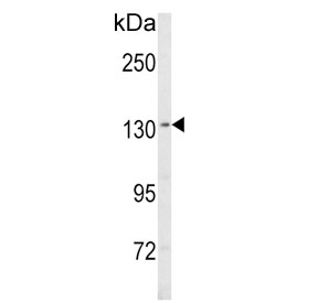 Western blot testing of human MDA-MB-435 cell lysate with SREBF1 antibody. Predicted molecular weight ~122 kDa.