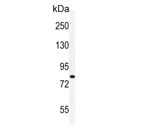 Western blot testing of human HepG2 cell lysate with Cadherin 20 antibody. Predicted molecular weight ~89 kDa.