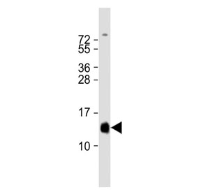 Western blot testing of human fetal heart tissue lysate with HBA2 antibody.  Predicted molecular weight ~15 kDa.