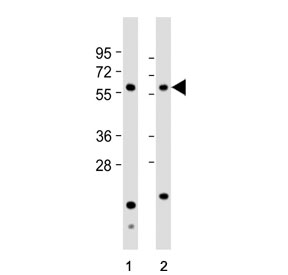 Western blot testing of human 1) HeLa and 2) HL60 cell lysate with Natriuretic peptide receptor C antibody. Predicted molecular weight ~60 kDa.