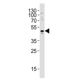Western blot testing of human A549 cell lysate with MMP10 antibody. Predicted molecular weight ~54 kDa.