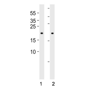 Western blot analysis of lysate from 1) HeLa, 2) 293, 3) HT-1080, 4) Raji, 5) SH-SY5Y and 6) THP-1 cell line using BAX antibody at 1:1000.