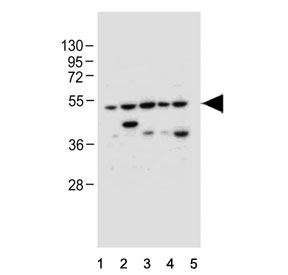Western blot testing of human 1) HeLa, 2) U-251 MG, 3) U-87 MG, 4) U-2 OS and 5) MCF7 cell lysate with Gasdermin E antibody. Predicted molecular weight ~55 kDa.