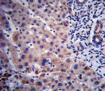 IHC staining of FFPE human liver tissue with CYP3A4 antibody. HIER: steam section in pH6 citrate buffer for 20 min and allow to cool prior to staining.