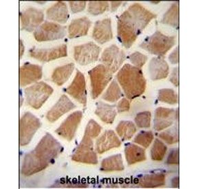 IHC staining of FFPE human skeletal muscle tissue with WISP-2 antibody. HIER: steam section in pH6 citrate buffer for 20 min and allow to cool prior to staining.