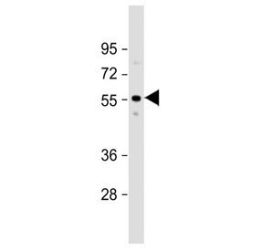 Western blot testing of human fetal liver tissue lysate with ACVR2A antibody. Predicted molecular weight ~58 kDa.