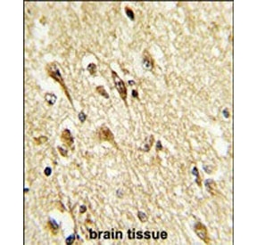 IHC staining of FFPE human brain tissue with VGluT2 antibody. HIER: steam section in pH6 citrate buffer for 20 min and allow to cool prior to staining.