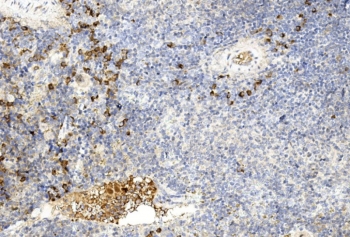 IHC staining of FFPE mouse spleen tissue with GREM1 antibody. HIER: steam section in pH6 citrate buffer for 20 min and allow to cool prior to staining.