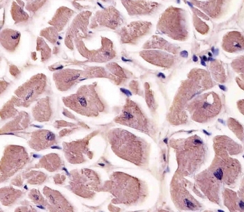 IHC staining of FFPE human heart tissue with Myosin-binding protein C antibody. HIER: steam section in pH6 citrate buffer for 20 min and allow to cool prior to staining.