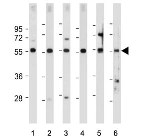 Western blot testing of 1) human HEK293, 2) human U-2 OS, 3) human U-87 MG, 4) human Y79, 5) mouse kidney and 6) mouse eyeball tissue lysate with FOXD1 antibody. Predicted molecular weight ~46 kDa.