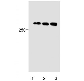 Western blot testing of human 1) HeLa, 2) HepG2 and 3) A549 cell lysate with PIEZO2 antibody. Expected molecular weight ~318 kDa.