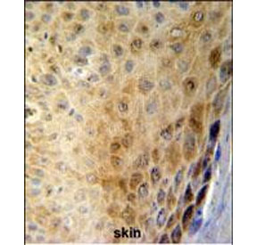 IHC staining of FFPE human skin tissue with GSDMA antibody. HIER: steam section in pH6 citrate buffer for 20 min and allow to cool prior to staining.