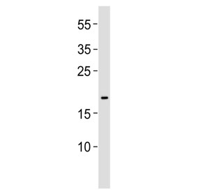 Western blot testing of human MCF7 cell lysate with EFNA1 antibody. Predicted molecular weight ~24 kDa, 21 kDa (two isoforms).