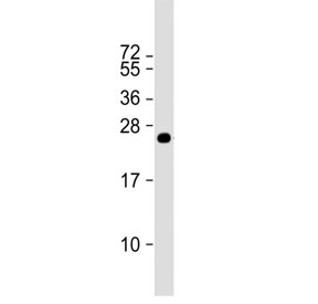 Western blot testing of a recombinant human partial protein with  MLL3 antibody. Predicted molecular weight of the full length protein ~541 kDa.
