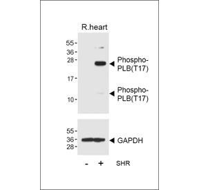 Western blot testing of lysate from normal rat heart tissue and spontaneous hypertensive (SHR) rat heart tissue, using Phospho-PLB antibody.