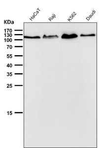 All lanes use the antibody at 1:3K dilution for 1 hour at room temperature. Predicted molecular weight ~104 kDa.
