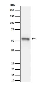 Western blot analysis of Phospho-Tau (S199) expression in mouse hippocampus cell lysate using Phospho-Tau (Ser199) antibody. The expected molecular weight of phosphorylated Tau (Ser198) is approximately 45-70 kDa, corresponding to the major Tau isoforms, and lower molecular weight bands around ~35 kDa may represent truncated Tau fragments commonly observed in brain tissue.