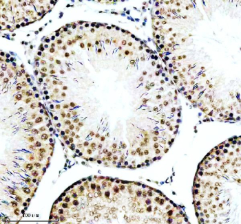 IHC analysis of RBBP6 using anti-RBBP6 antibody. RBBP6 was detected in a paraffin-embedded section of rat testis tissue. Heat mediated antigen retrieval was performed in EDTA buffer (pH 8.0, epitope retrieval solution). The tissue section was blocked with 10% goat serum. The tissue section was then incubated with 2 ug/ml rabbit anti-RBBP6 antibody overnight at 4oC. Peroxidase Conjugated Goat Anti-rabbit IgG was used as secondary antibody and incubated for 30 minutes at 37oC. The tissue section was developed using an HRP secondary and DAB substrate.