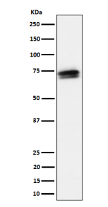 Western blot analysis of SSX2IP expression in HeLa cell lysate using SSX2IP antibody. The expected band size for SSX2IP is at 71 kDa. The protein is observed as multiple species with apparent molecular weights of 70-90 kDa, corresponding to differentially phosphorylated isoforms.
