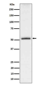 Western blot analysis of Phospho-Tau (S198) expression in mouse hippocampus cell lysate. The expected molecular weight of phosphorylated Tau (Ser198) is approximately 45-70 kDa, corresponding to the major Tau isoforms, and lower molecular weight bands around ~35 kDa may represent truncated Tau fragments commonly observed in brain tissue.