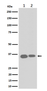 Western blot analysis of ELOVL5 expression in (1) human HeLa cell lysate; (2) mouse RAW264.7 cell lysate. Predicted molecular weight ~35 kDa and ~38 kDa (two isoforms).