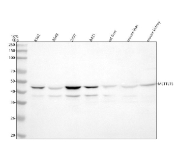 Western blot analysis of METTL15 using anti-METTL15 antibody. Lane 1: human K562 whole cell lysates, Lane 2: human whole cell lysates, Lane 3: human 293T whole cell lysates, Lane 4: human whole cell lysates, Lane 5: rat liver tissue lysates, Lane 6: mouse liver tissue lysates, Lane 7: mouse kidney tissue lysates. After electrophoresis, proteins were transferred to a nitrocellulose membrane at 150 mA for 50-90 minutes. Blocked the membrane with 5% non-fat milk/TBS for 1.5 hour at RT. The membrane was incubated with rabbit anti-METTL15 antibody at 0.5 ug/ml overnight at 4oC, then washed with TBS-0.1%Tween 3 times with 5 minutes each and probed with a goat anti-rabbit IgG-HRP secondary antibody at a dilution of 1:5000 for 1.5 hour at RT. The signal was developed using enhanced chemiluminescent. Expected molecular weight ~46âkDa (full-length METTL15). Additional band at ~38âkDa observed in some samples; may correspond to a splice variant or proteolytic fragment of METTL15, transcript variants of METTL15 are documented.