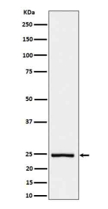 Western blot analysis of IL26 in His-tagged IL26 transfected cell lysate using IL26 antibody.