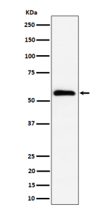 Western blot analysis of PNK / PNKP expression in human HeLa cell lysate using PNKP antibody. Predicted molecular weight ~57 kDa.