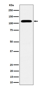 Western blot analysis of SEC24D expression in human HeLa cell lysate using SEC24D antibody. Predicted molecular weight ~113 kDa.