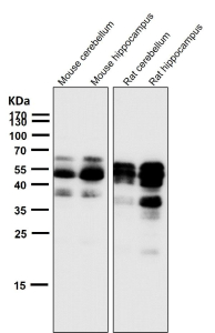 All lanes use the Phospho-Tau (Ser404) antibody at 1:2K dilution for 1 hour at room temperature. The expected molecular weight of phosphorylated Tau (Ser198) is approximately 45-70 kDa, corresponding to the major Tau isoforms, and lower molecular weight bands around ~35 kDa may represent truncated Tau fragments commonly observed in brain tissue.