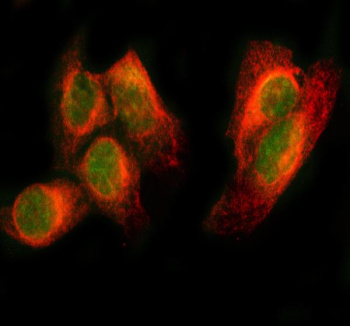 IF analysis of PAX8 using anti-PAX8 antibody (green) and anti-Beta Tubulin antibody (red). PAX8 was detected in immunocytochemical section of HELA cell. Enzyme antigen retrieval was performed using IHC enzyme antigen retrieval reagent for 15 mins. The cells were blocked with 10% goat serum. And then incubated with 5 ug/ml rabbit anti-PAX8 antibody and mouse anti-Beta Tubulin antibody overnight at 4oC. DyLight 488 Conjugated Goat Anti-Rabbit IgG and Cy3 Conjugated Goat Anti-Mouse IgG were used as secondary antibody at 1:500 dilution and incubated for 30 minutes at 37oC. Visualize using a fluorescence microscope and filter sets appropriate for the label used.