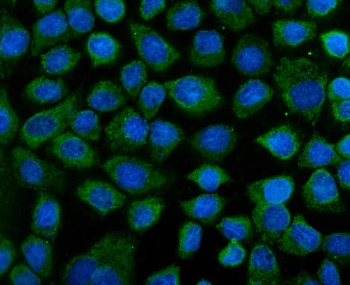 IF analysis of KEAP1 using anti-KEAP1 antibody (green). KEAP1 was detected in an immunocytochemical section of cells. Enzyme antigen retrieval was performed using IHC enzyme antigen retrieval reagent for 15 mins. The cells were blocked with 10% goat serum. And then incubated with 5 ug/ml rabbit anti-KEAP1 antibody overnight at 4oC. DyLight 488 Conjugated Goat Anti-Rabbit IgG was used as secondary antibody at 1:100 dilution and incubated for 30 minutes at 37oC. The section was counterstained with DAPI (blue). Visualize using a fluorescence microscope and filter sets appropriate for the label used.