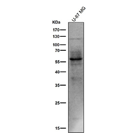 All lanes use the Phospho-Tau (Ser214) antibody at 1:1k dilution for 1 hour at room temperature. The expected molecular weight of phosphorylated Tau (Ser198) is approximately 45-70 kDa, corresponding to the major Tau isoforms, and lower molecular weight bands around ~35 kDa may represent truncated Tau fragments commonly observed in brain tissue.