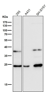 All lanes use the antibody at 1:1K dilution for 1 hour at room temperature.