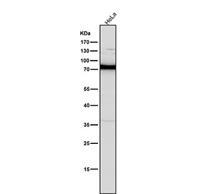All lanes use the PKC antibody at 1:5K dilution for 1 hour at room temperature.