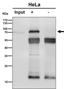 Immunoprecipitation analysis using the antibody at 1:50 dilution. (Western blot at 1:1K dilution)
