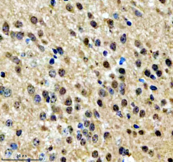 Immunohistochemical staining of NPAT using anti-NPAT antibody. NPAT was detected in a paraffin-embedded section of mouse brain tissue. Heat mediated antigen retrieval was performed in EDTA buffer (pH 8.0, epitope retrieval solution). The tissue section was blocked with 10% goat serum. The tissue section was then incubated with 2 ug/ml rabbit anti-NPAT antibody overnight at 4oC. Peroxidase Conjugated Goat Anti-rabbit IgG was used as secondary antibody and incubated for 30 minutes at 37oC. The tissue section was developed using an HRP secondary and DAB substrate.